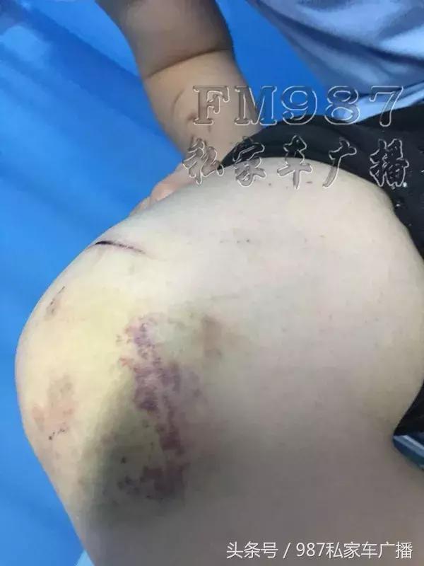 合肥滴滴顺风车事故拒赔 (福州滴滴网约车凌晨两点发生事故)