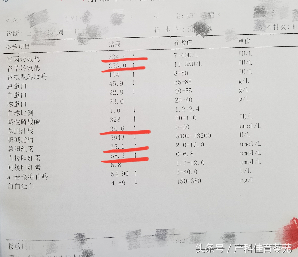 妊娠期肝功能异常是怎么回事,孕期胆汁淤积看肝功哪个指标