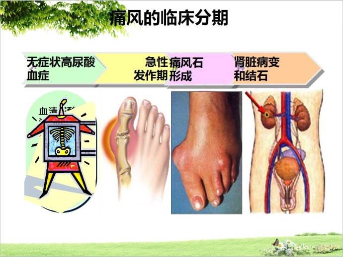乌鸡白凤丸可以治男人肾虚吗,乌鸡白凤丸既能治病又能养颜
