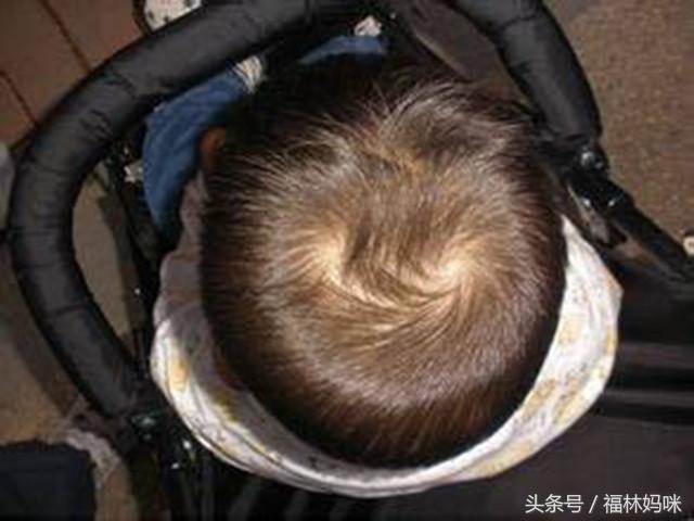 头发旋方向和性格有什么关系,宝宝头上一个旋有什么说法吗