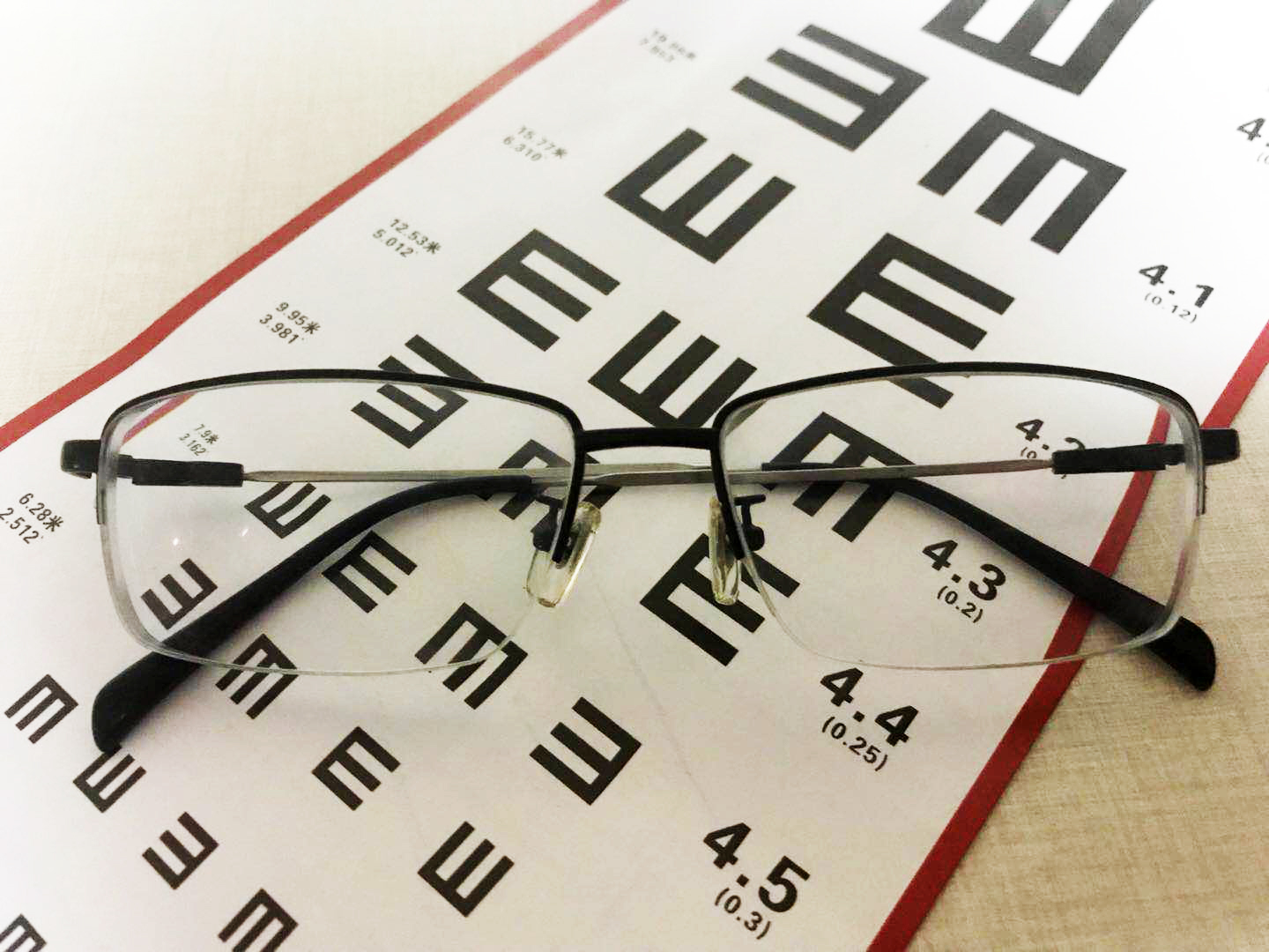 做过近视手术的真实经历,有没有做过近视手术的恐惧感受