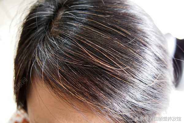 国颐堂养发馆防脱生发效果怎么样,国颐堂养发骗局揭秘