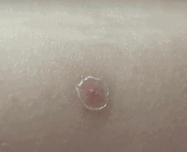 超好用的祛痘组合,祛痘产品测评排行榜