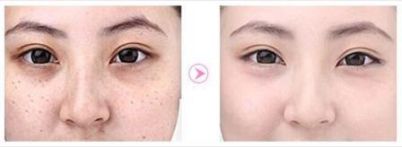 范冰冰推荐祛斑,范冰冰推荐美白淡斑面膜