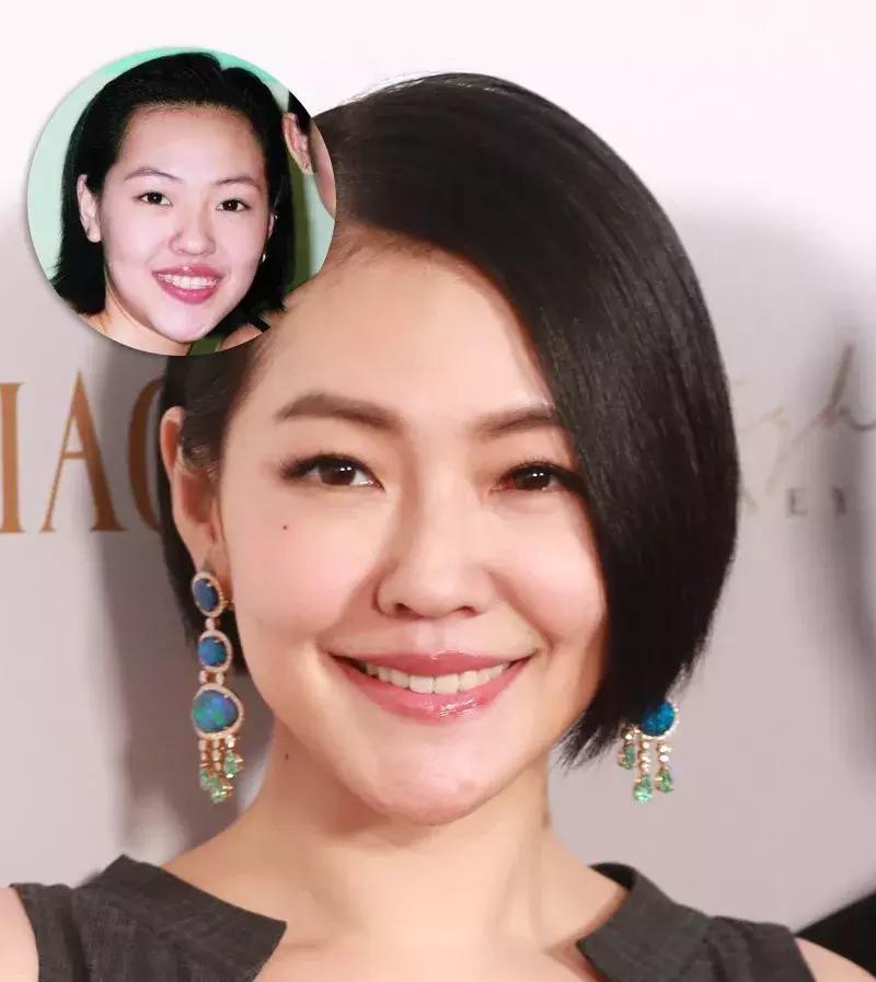 还在犹豫是否整牙，明星们默默变美都在靠它，你想知道的这篇都有