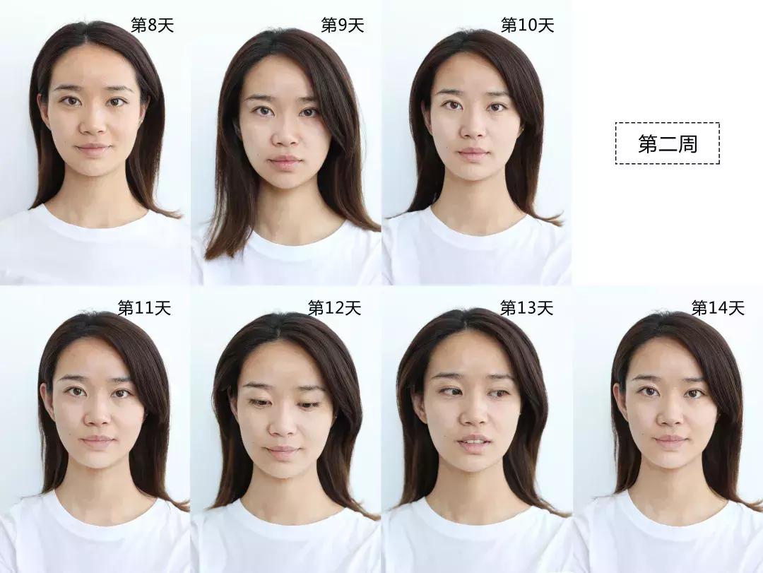 vc精华淡化法令纹暗沉,vc用了法令纹发黄