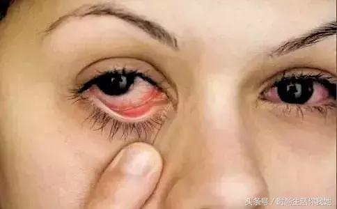 怎么放大双眼不化妆,化妆怎么放大眼睛