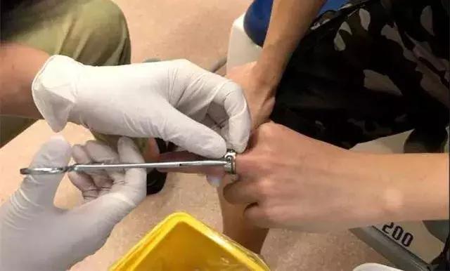 网红疤痕膏靠谱吗,网红祛疤产品真的有效吗