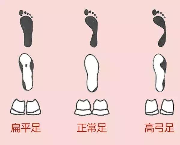 鞋底足跟外侧磨得多是怎么回事,鞋底歪向一边什么问题