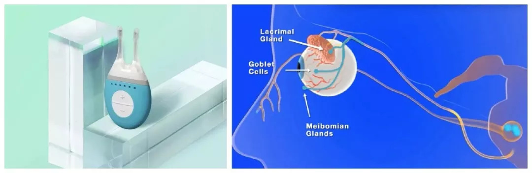 近期已问世和最值得期待的干眼症治疗新药和设备