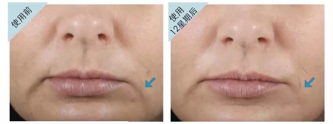 测评护肤品专业,测评最好的护肤套装