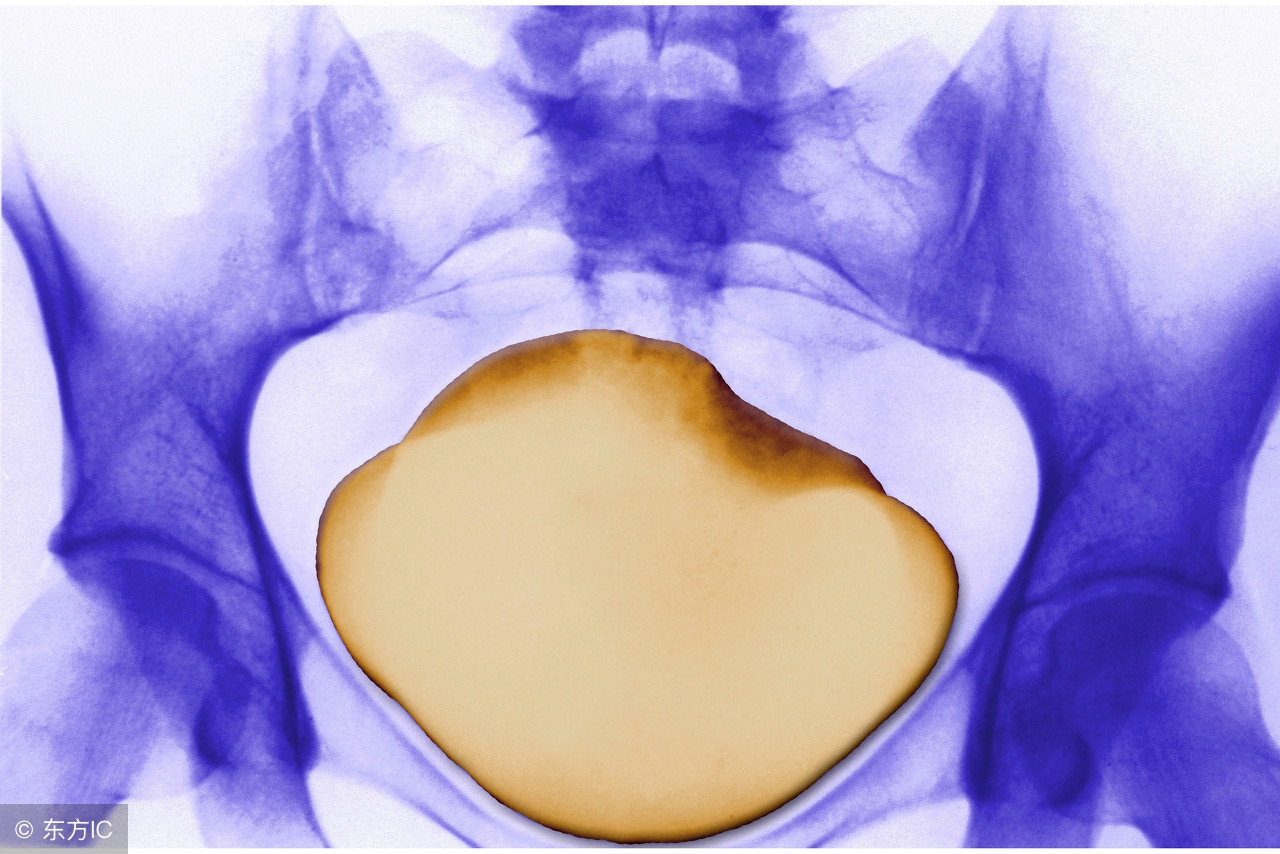 引起尿道突出的原因有哪些,都有什么疾病可以导致尿道口疼