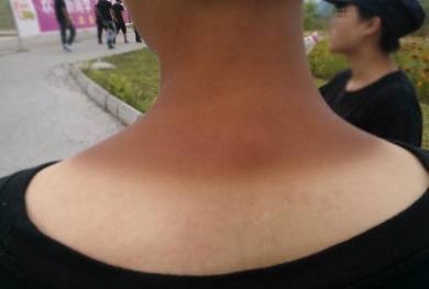 军训完快速美白的方法,军训如何防止晒黑学生党