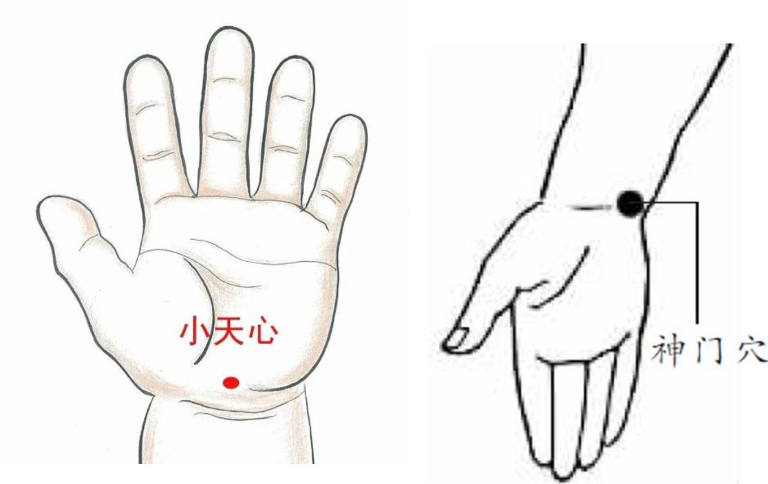 宝宝出疹一直高烧怎么办,宝宝出急疹都是发高烧吗