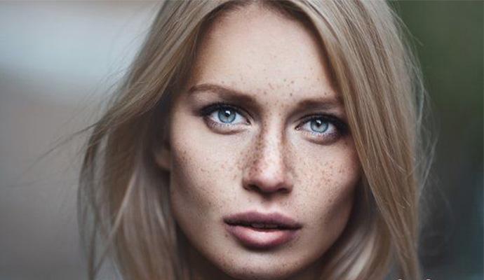 脸颊两边长斑的原因及治疗方法,脸颊两边长斑什么原因怎么治疗