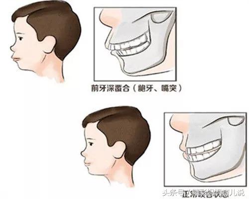 小孩吃饭慢吞吞老是含在嘴里,幼儿吃饭含在嘴里不咽的原因分析