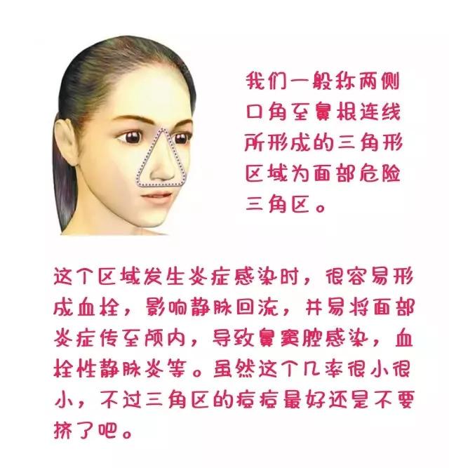 脸上长痘痘了教你一招快速祛痘,专治脸上痘痘的土方法