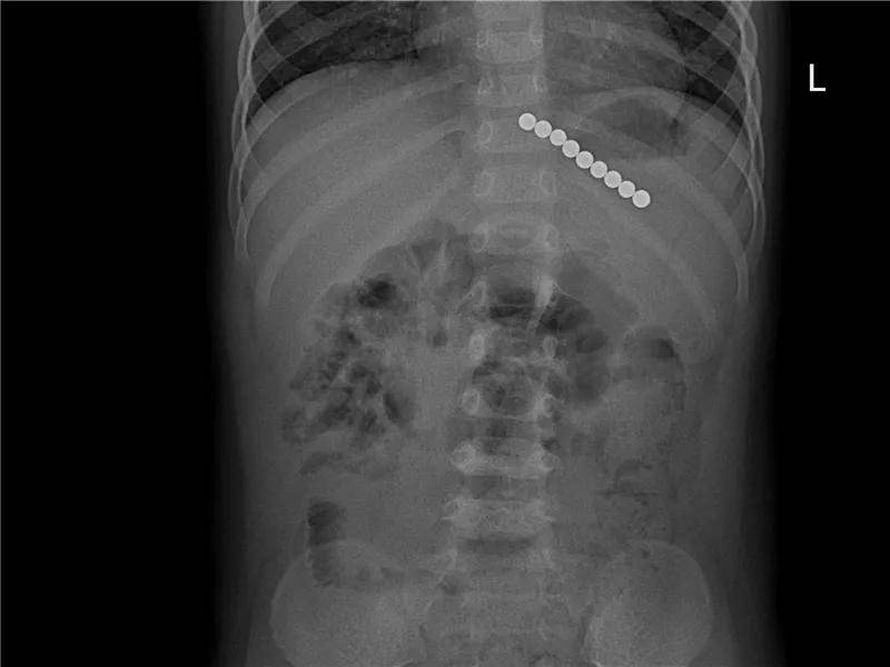 一些让人毛骨悚然拍到的照片,六个令人毛骨悚然的影像