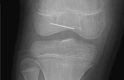 一些让人毛骨悚然拍到的照片,六个令人毛骨悚然的影像