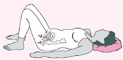 拔掉尿管后感觉不到尿憋怎么办,尿潴留能憋死吗