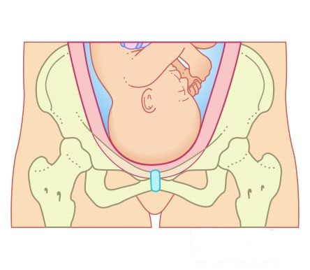 出现了宫缩多久会生产,要分娩前的宫缩征兆