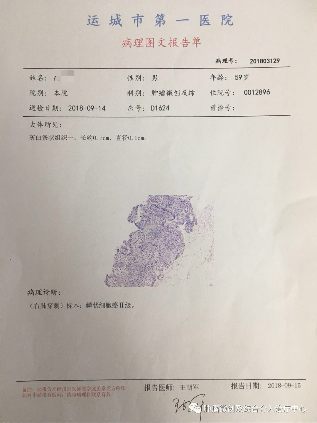 肺癌的诊断+综合介入治疗（穿刺活检+肿瘤血管栓塞+消融+碘125例子植入）—运城市第一医院肿瘤微创及综合介入科