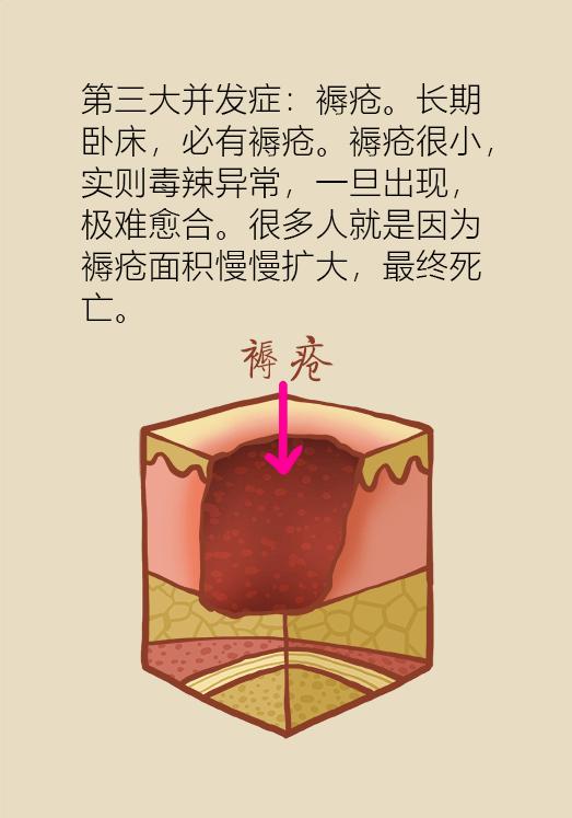 老人股骨颈骨折后死亡率高达50%，提醒爸妈一定要注意！