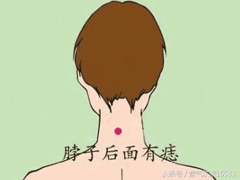 痣相图解:女人脖子上有痣图解