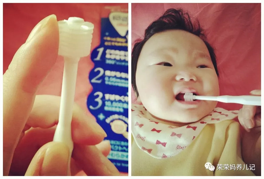 乳牙蛀牙可以不管它吗,孩子乳牙没换就蛀牙了需要补吗