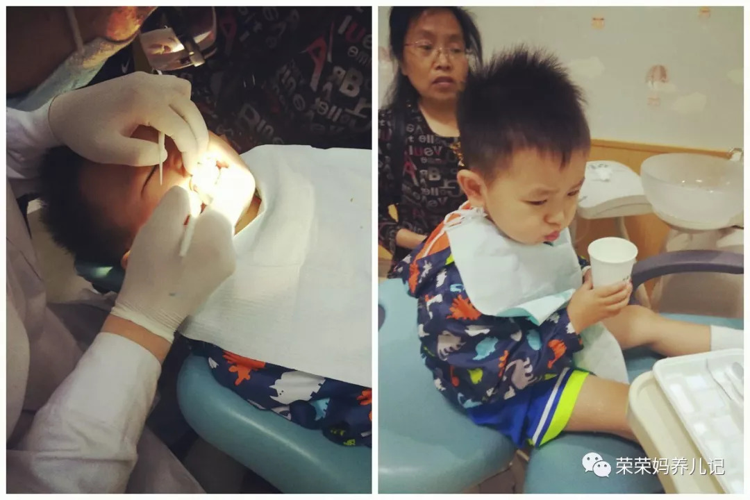 乳牙蛀牙可以不管它吗,孩子乳牙没换就蛀牙了需要补吗