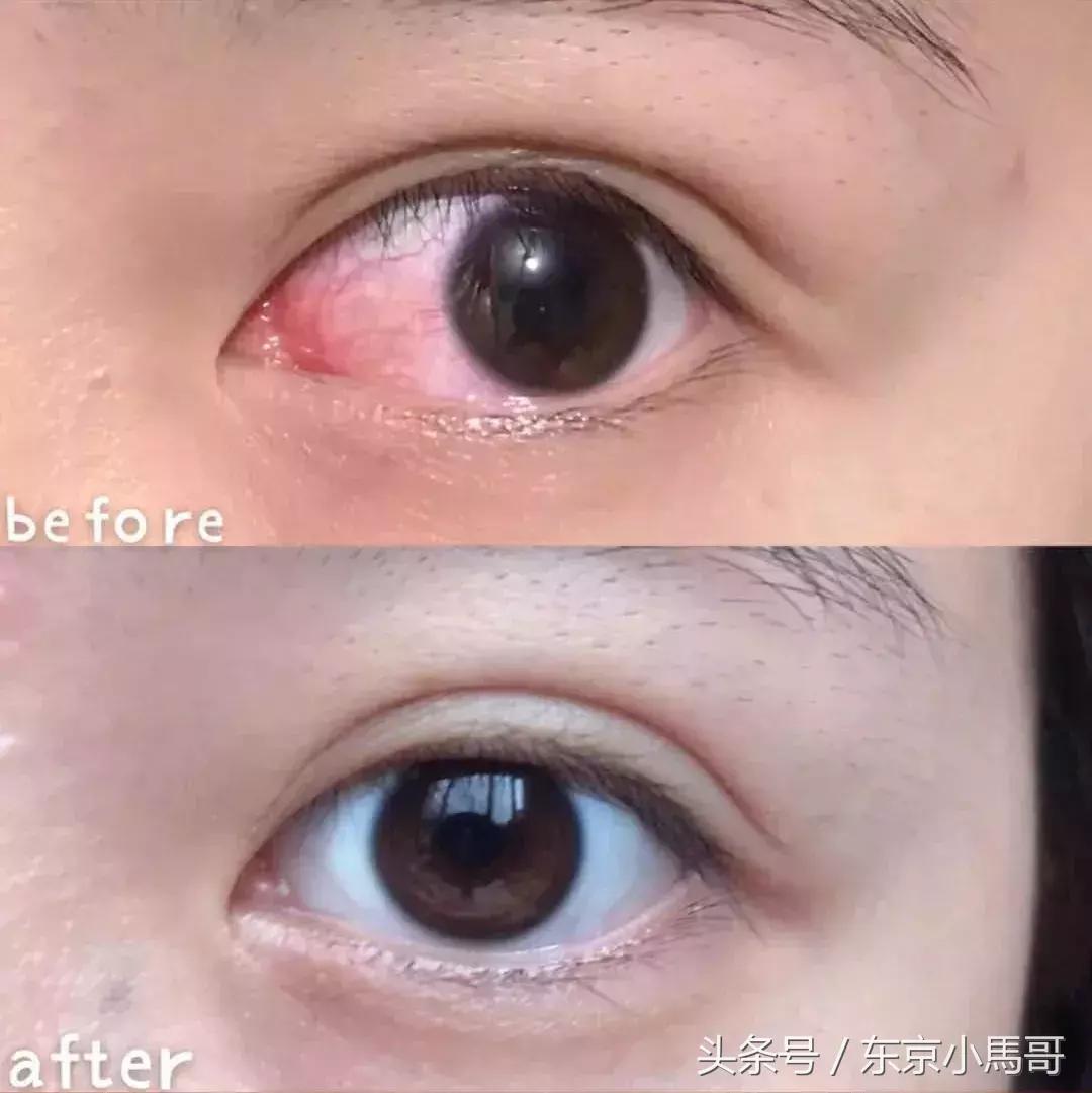 日本好用的祛红血丝眼药水 (日本爱马仕眼药水)