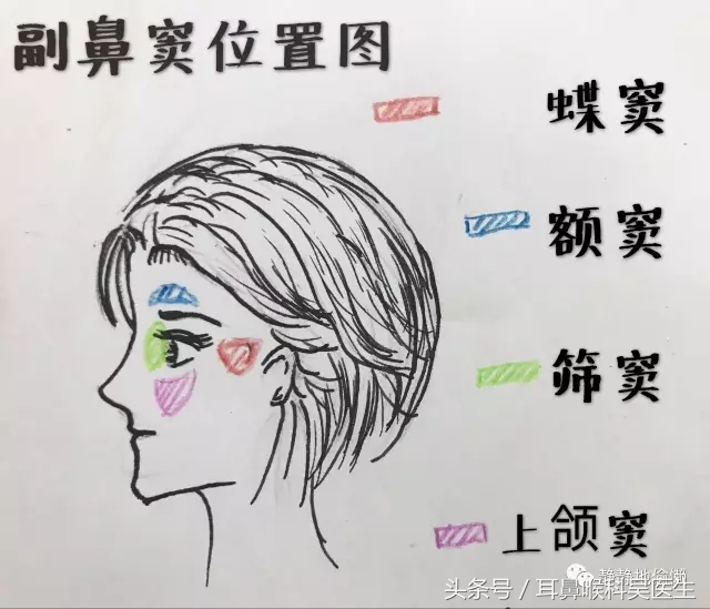 鼻炎鼻窦炎鼻息肉有什么区别,鼻炎和鼻窦炎究竟有什么区别