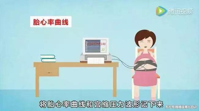 孕妈产检必备攻略，一定要收藏！