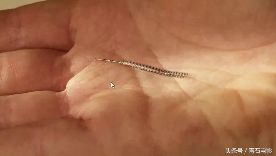 4公分线圈可避孕，护士曾为其代言，但纪录片上映后产品遭停售！