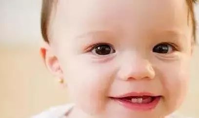 牙龈出血多跟吐血似的,吃苹果牙龈出血要警惕三种病