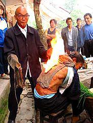 火疗爱好者，必须注意的问题