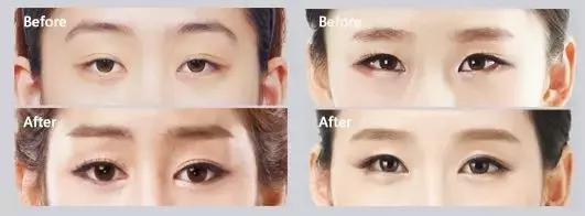 美瞳线睁眼闭眼都有神,美瞳线是睁眼有神闭眼无痕的