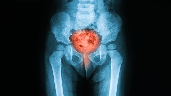 啪啪后尿痛甚至还有血尿，youarenotalone