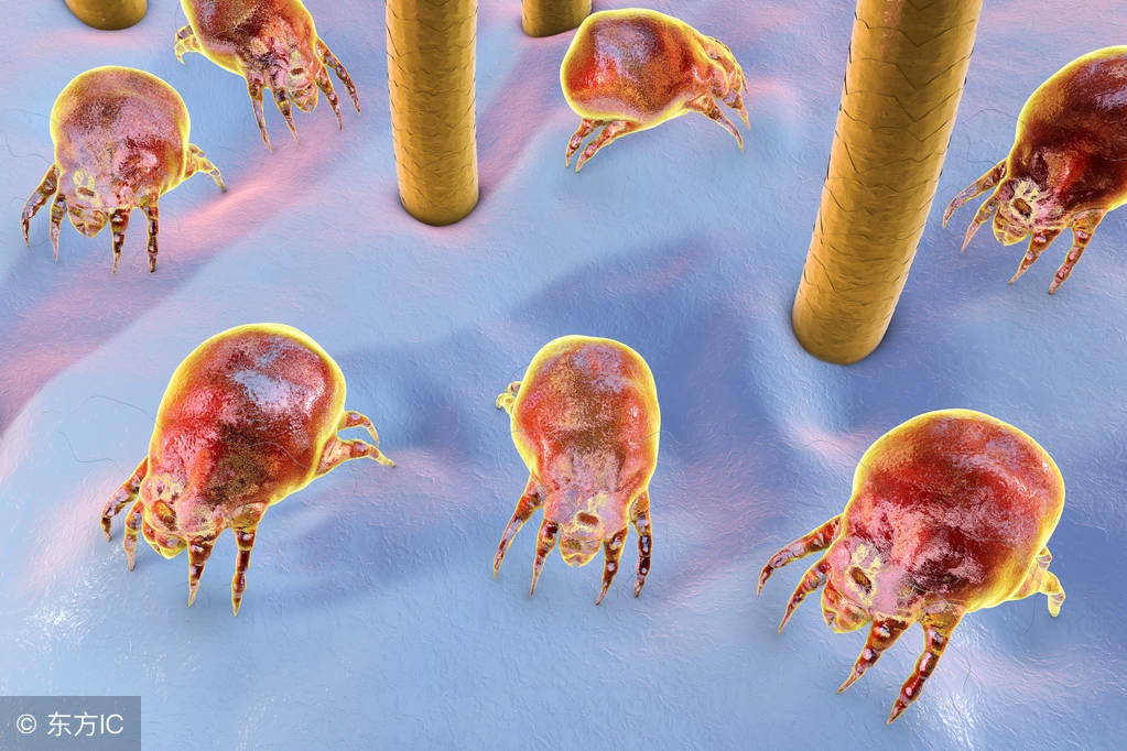 除螨虫最简单方法是什么,螨虫最快最有效的去除方法