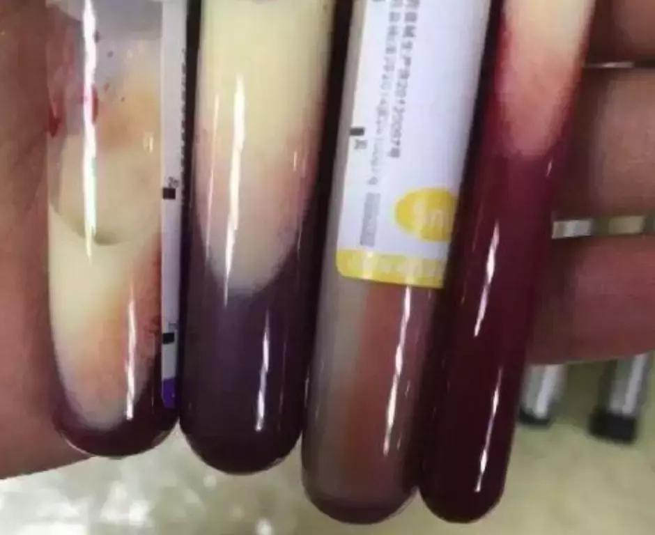 好好吃饭才是最好的爱自己,好好吃饭真的是一种高级人生智慧