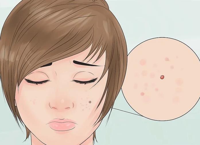 普通妇科能看内分泌失调吗,妇科内分泌失调最好的解决办法