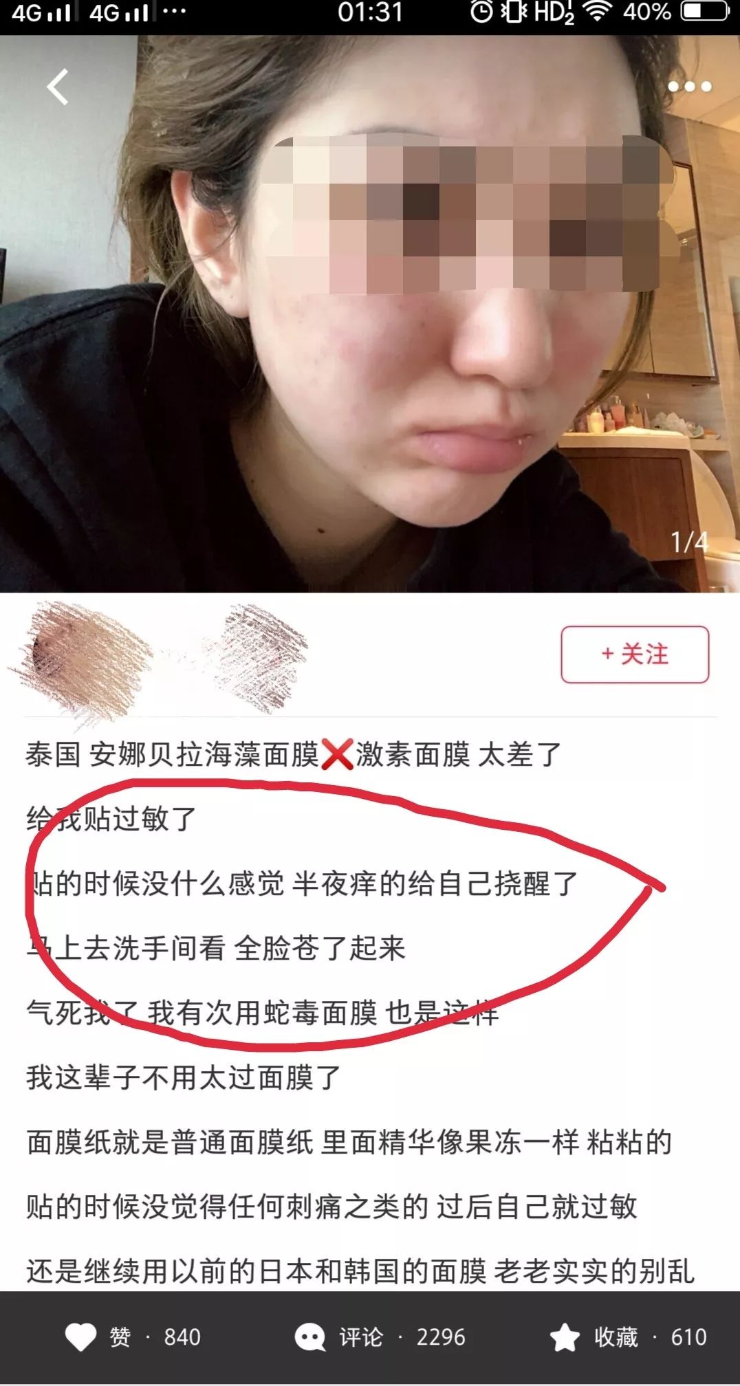 泰国蛇毒面膜真的全是激素吗,泰国蛇毒面膜真的假的