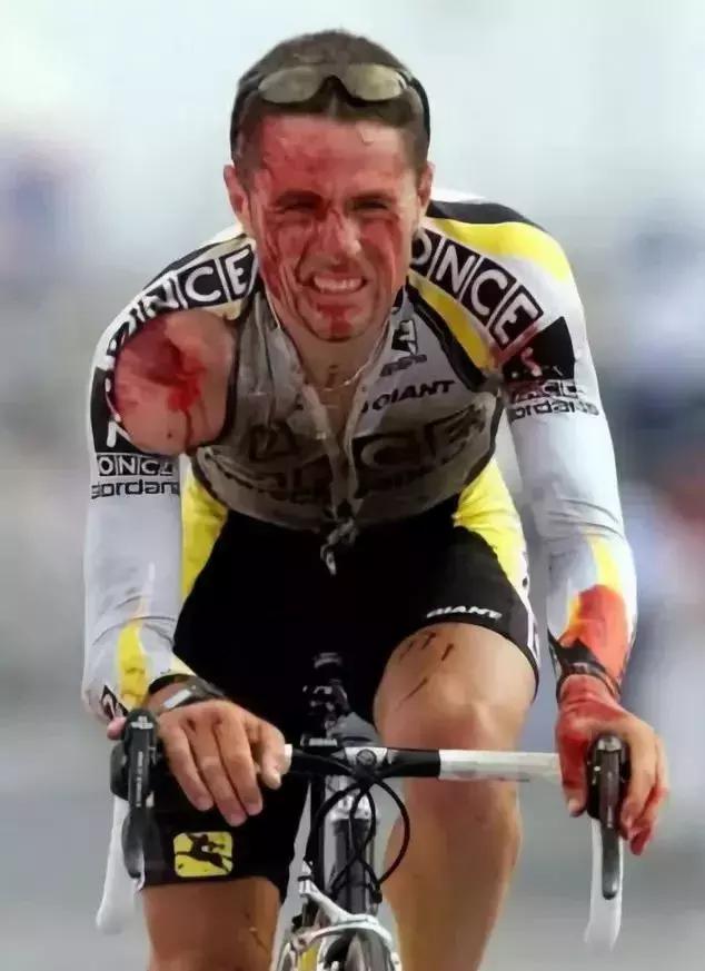 骑行常见的意外状况及处理方法,意外受伤需要注意什么