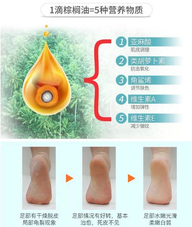 脚气奇痒难忍只需用它泡脚,去脚气脚臭痒最好最快办法