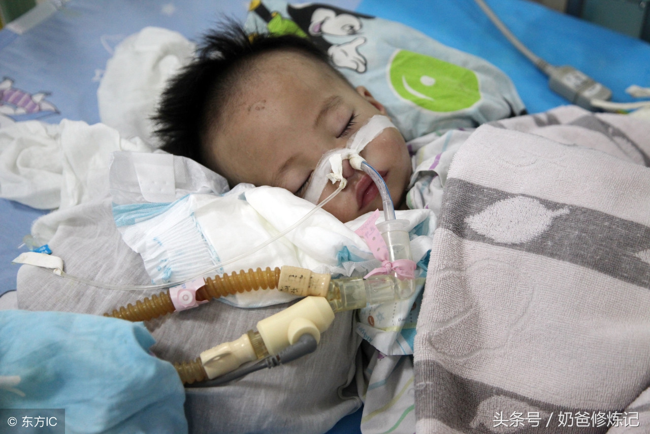 新生儿肺透明膜病的主要病因,认知婴幼儿