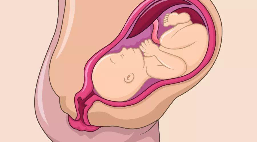 顺产要剪会阴吗,顺产要剪肉吗