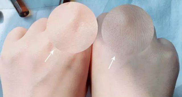 抗衰老的精华有哪些,抗衰老的物品有哪些