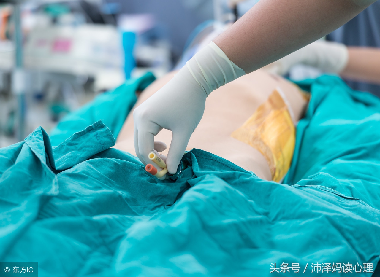 剖宫产与顺产最大区别,剖宫产和剖腹产的危险性