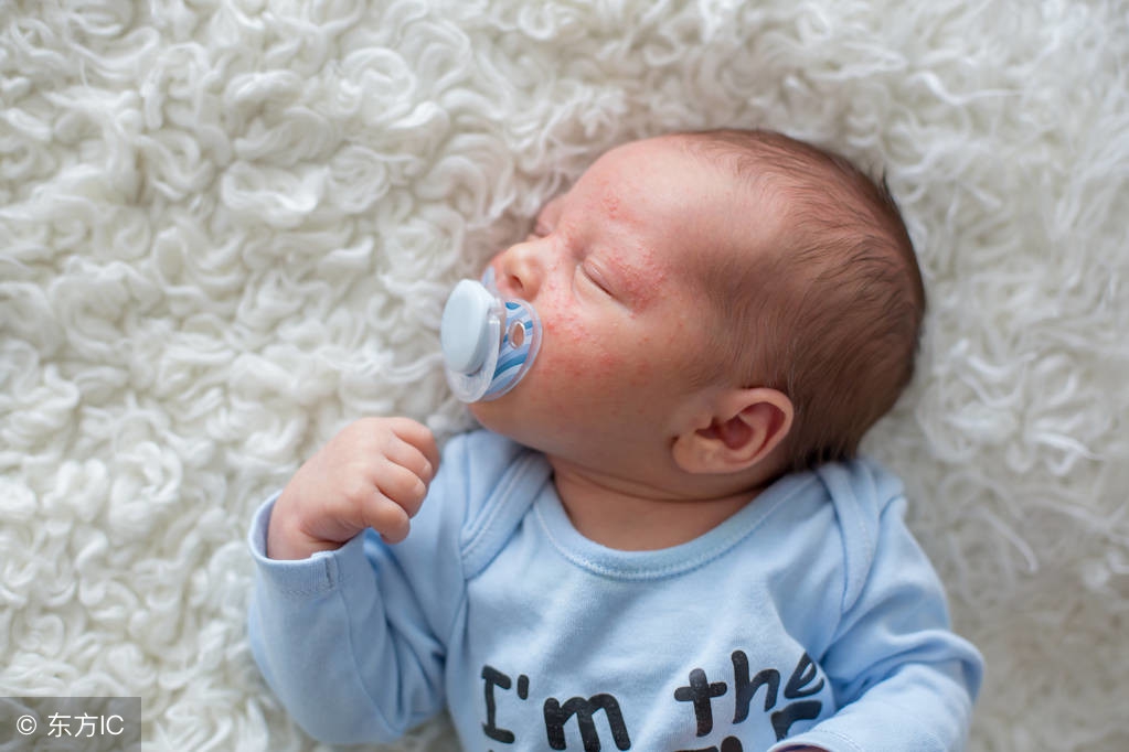 秋冬季节，新生宝宝容易遇“奶癣”！别急，多部分都能恢复正常