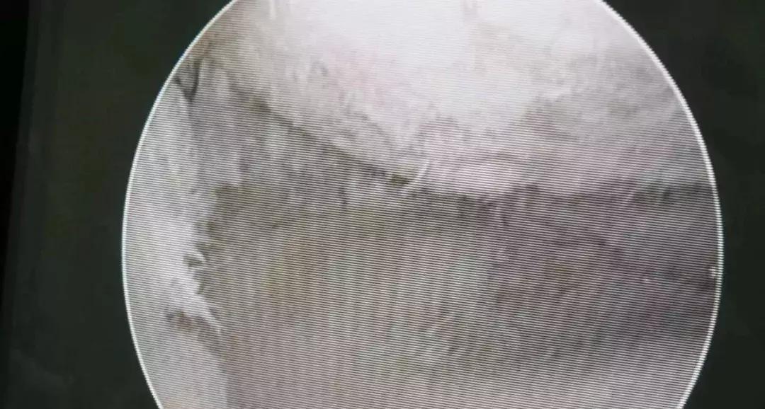 打篮球膝关节酸痛怎么办,打篮球打到胳膊疼是怎么回事